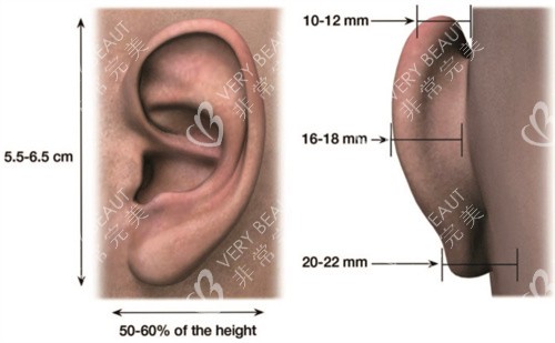 耳朵整形示意图