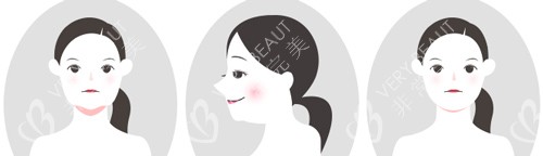 下颌缘下巴肉嘟嘟