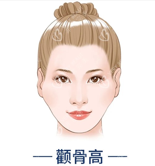 颧骨高动画图
