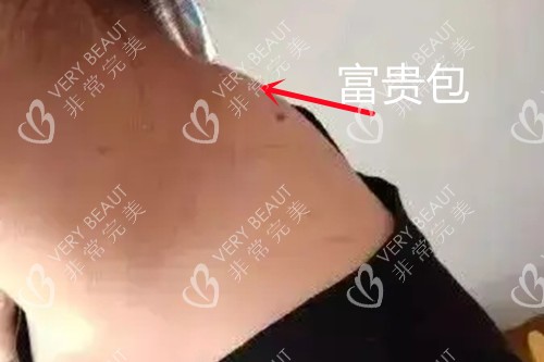 这富贵包怕是保不住了
