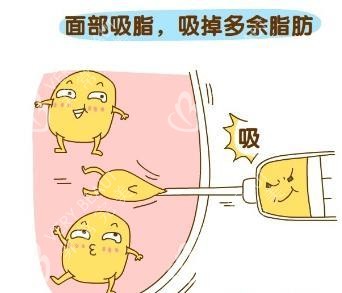 面部吸脂示意图