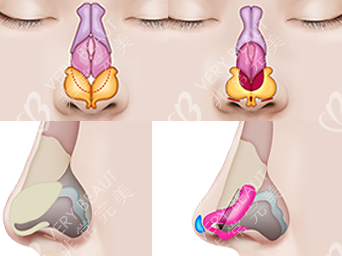 鼻子结构