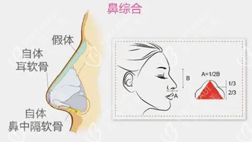 隆鼻综合改善治疗展示