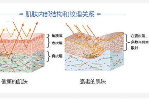 肌肤内部结构示意图