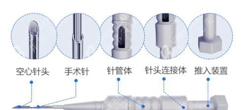 毛发移植笔示意图