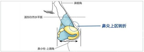 李信峰隆鼻设计