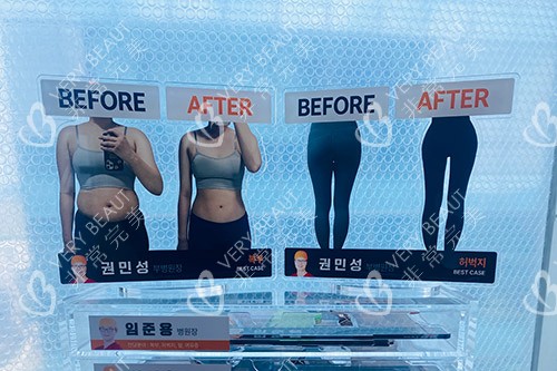 韩国365mc医院日记展示台
