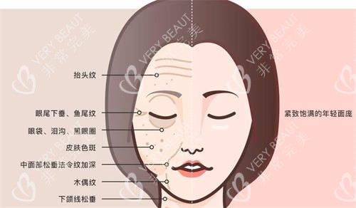 韩国珠儿丽整形医院候面部图