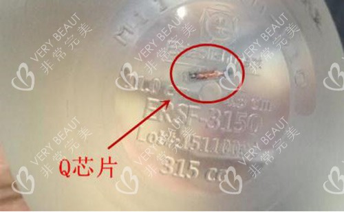 韩国魔滴假体带芯片示意图