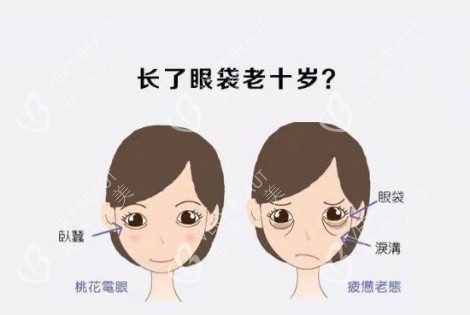 韓國431整形醫(yī)院眼部整形圖