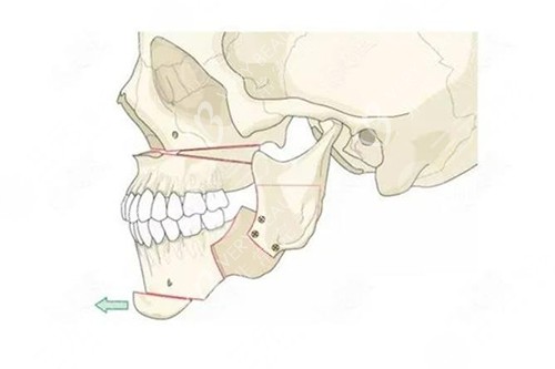 头部骨骼图