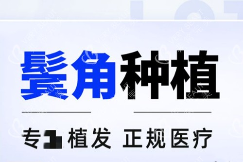 鬓角种植