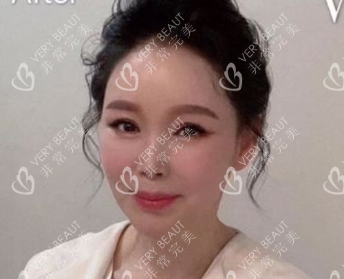 韩国VG百利酷整形外科拉皮后
