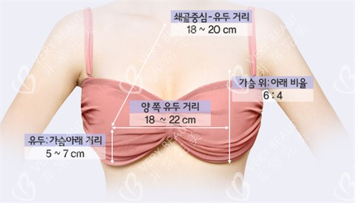 韩国菲斯莱茵胸部整形示意图
