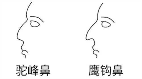 驼峰鼻与鹰钩鼻动画展示图