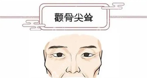 颧骨尖耸动漫参考图