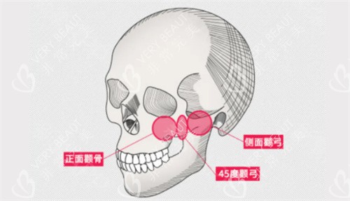颧骨具体位置详解图