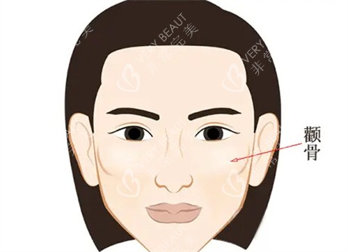 颧骨突出正面动画展示图