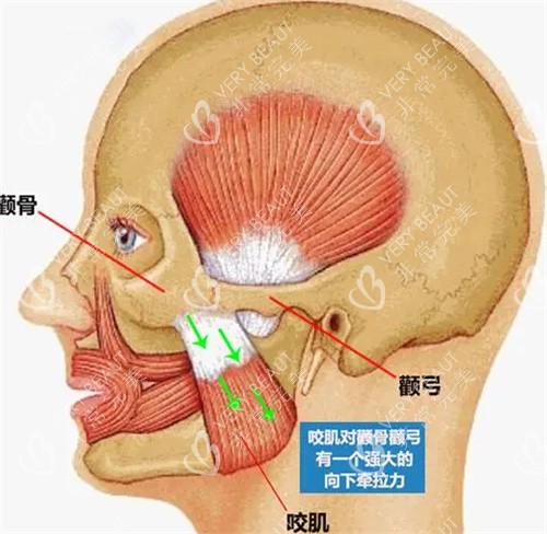 颧骨颧弓面部解剖图