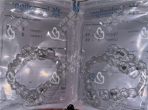 隱形牙套示意圖