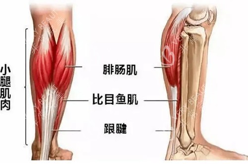 小腿肌肉结构示意图