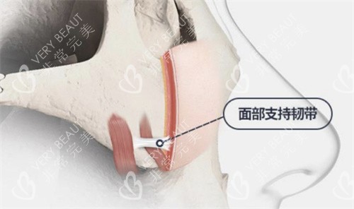 韓國TS整形面部支持韌帶圖