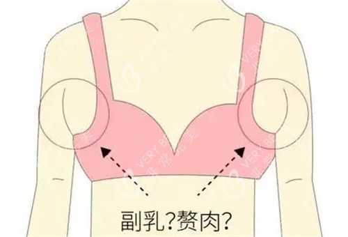 副乳动画图