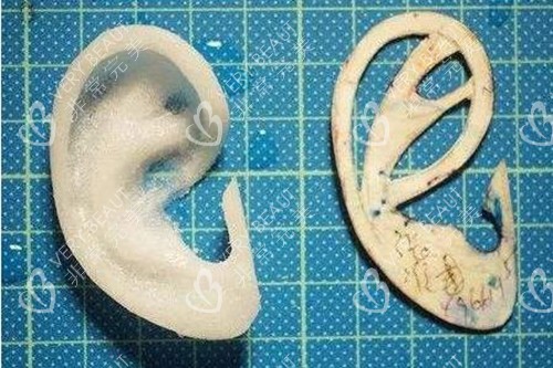 耳廓支架模型示意图