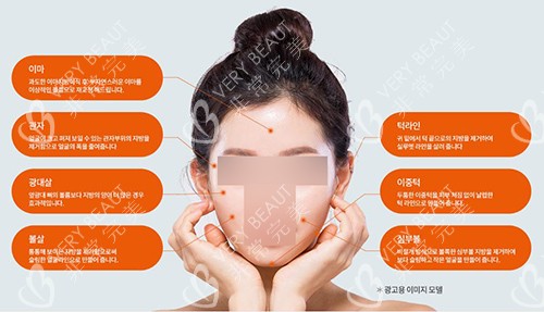 snow純手工V臉面部吸脂部位