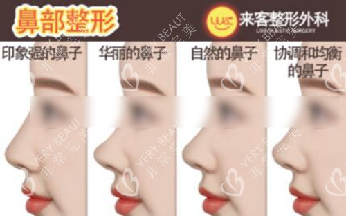 隆鼻改善治療照片圖