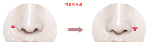 韓國格瑞絲噢愛美整形麗質(zhì)鼻