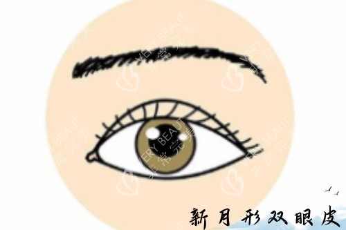 新月形双眼皮卡通图片展示