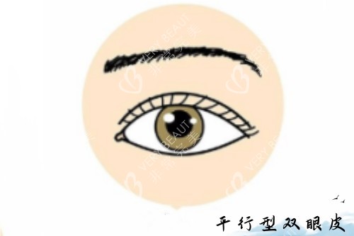 平行型双眼皮卡通图片展示