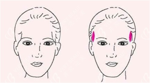 面部轮廓太阳穴展示图