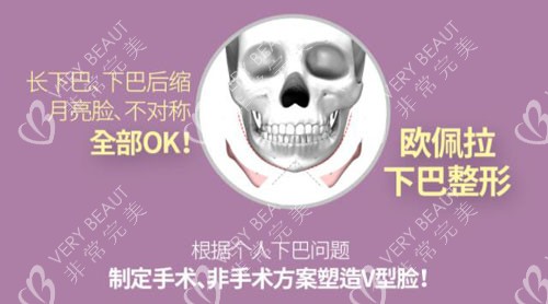 韓國歐佩拉整形輪廓手術特點介紹