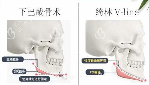 韓國(guó)綺林整形外科