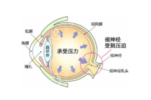 眼睛整体构造卡通图片展示