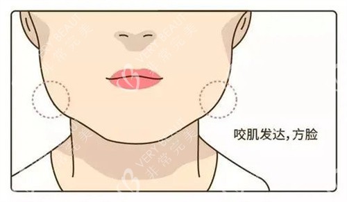 咬肌發(fā)達(dá)卡通圖