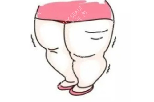 腿部肥胖卡通图片展示