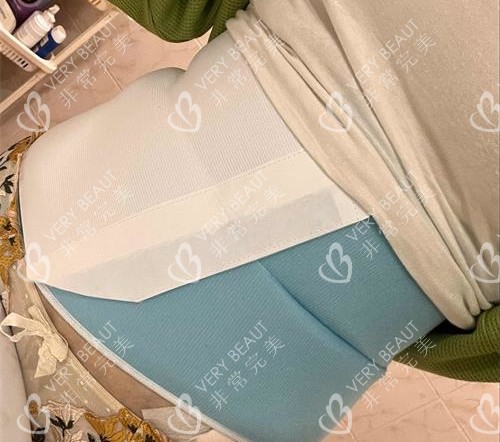 韓國qline女性醫(yī)院腰腹吸脂