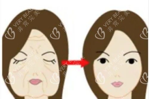 皮肤变年轻卡通图片展示