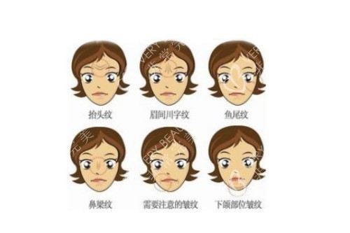 脸上各种皱纹卡通图片展示