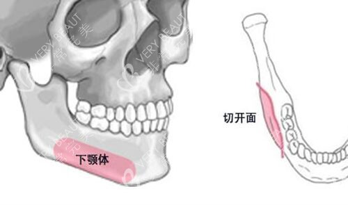 韓國(guó)菲斯萊茵整形輪廓手術(shù)特點(diǎn)