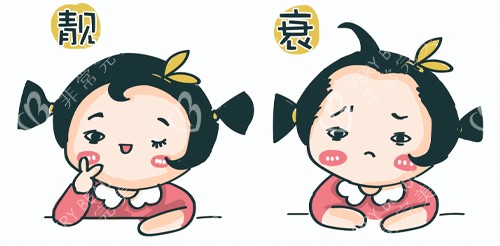 发际线种植后结果
