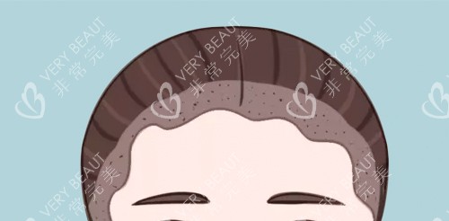 种植密度和形状