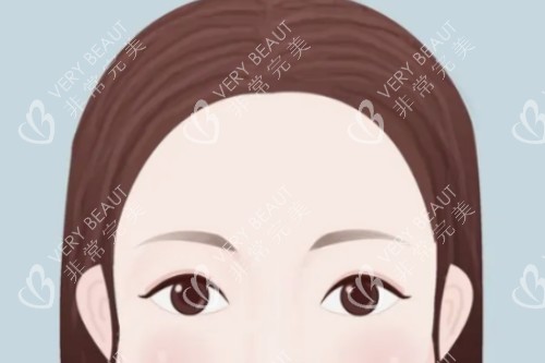 高颅顶卡通图