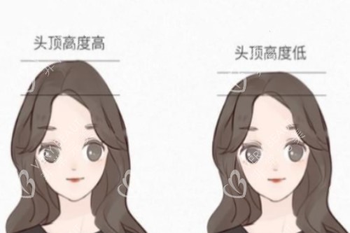颅顶高、颅顶低卡通对比图