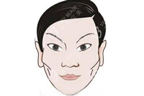脸颊凹陷卡通图片展示