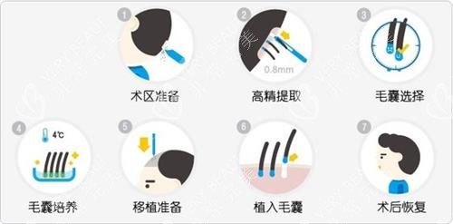 微针植发技术