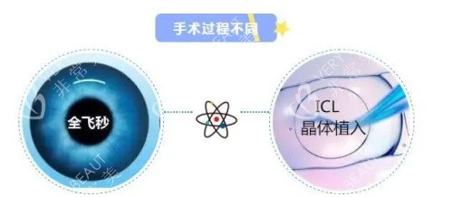 全飞秒手术和晶体植入手术的区别